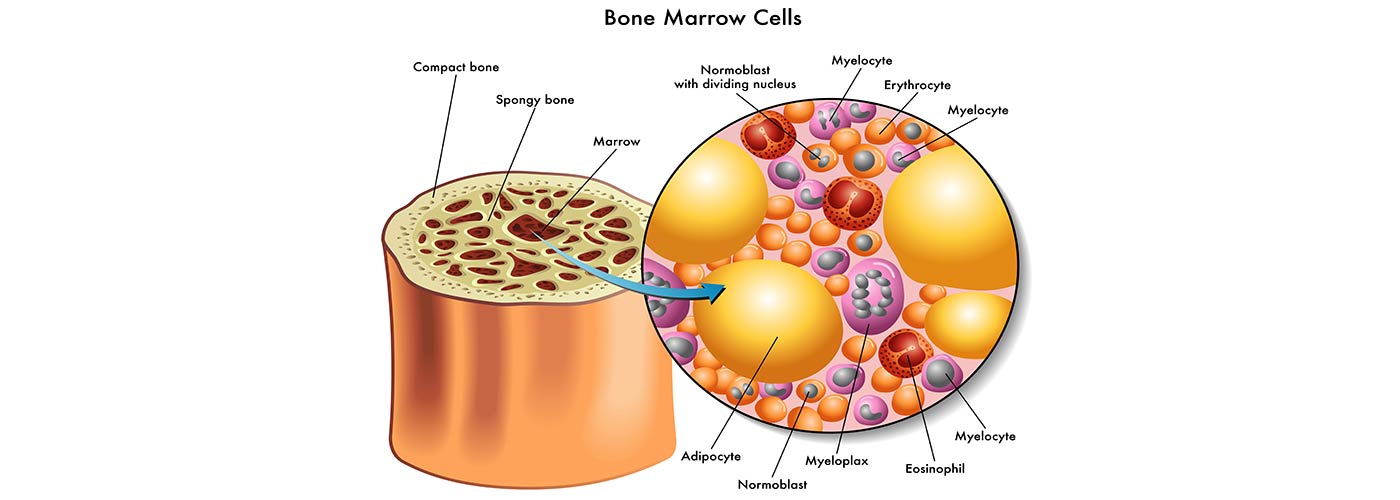 Does Methadone Get In Your Bone Marrow?