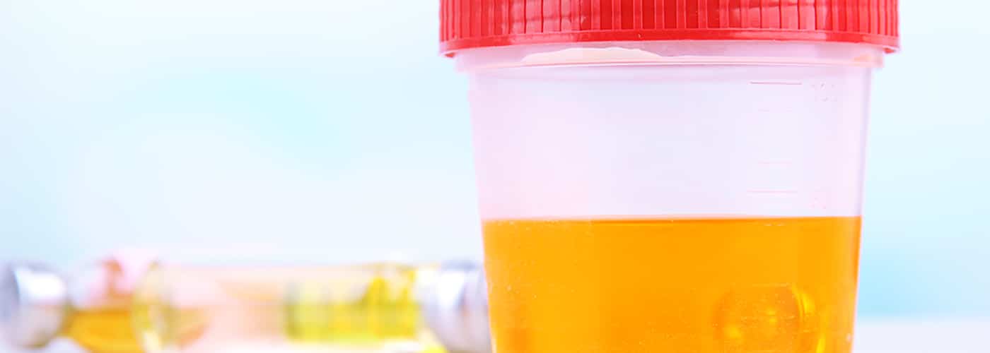 Differences Between a Urine and Saliva Drug Test